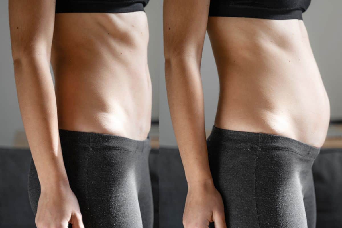 How long does diastasis recti take to improve Rayleigh?